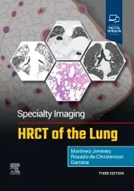 Specialty Imaging: HRCT of the Lung